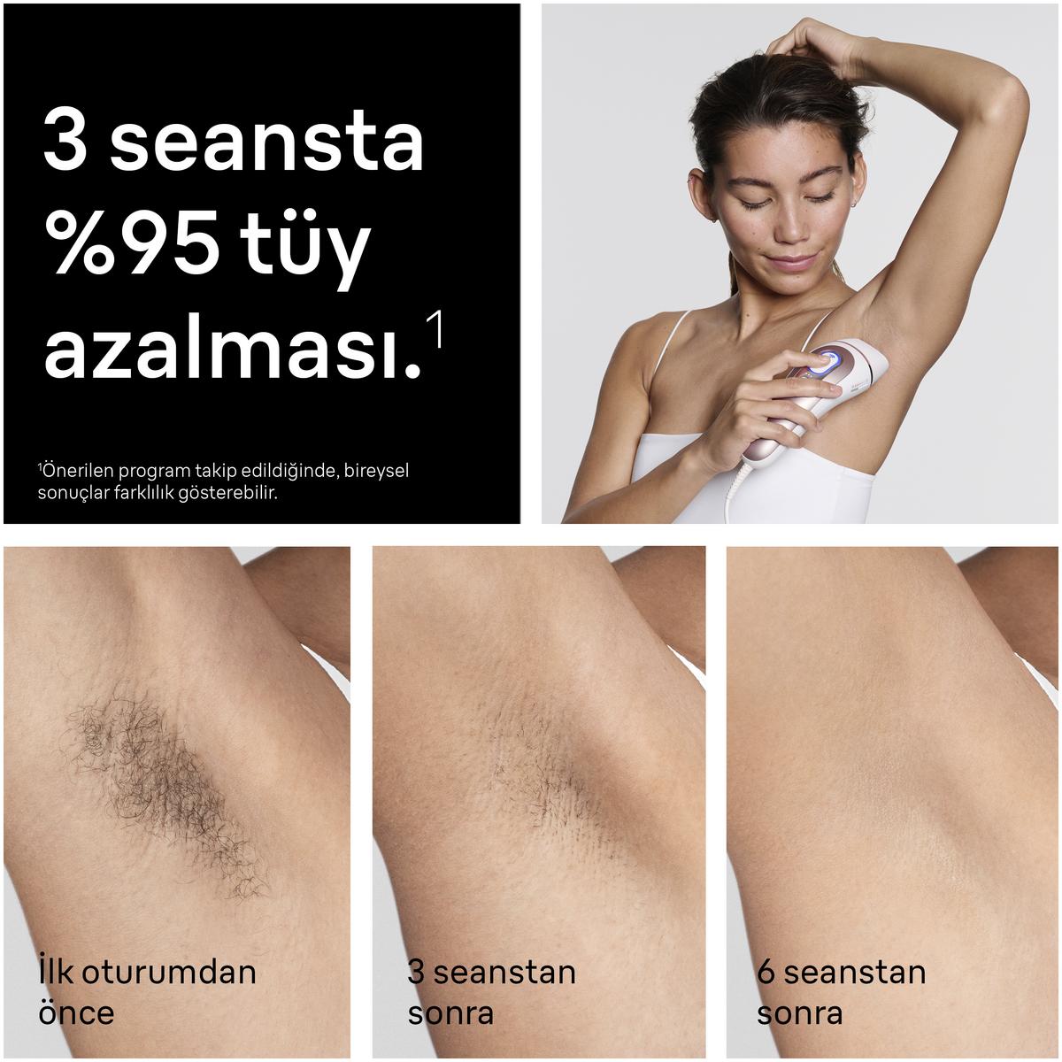 BRAUN PL7211 IPL Skin i Expert 2 Başlıklı, Evde Lazerle Tüy Alma, Çanta, Venus Tıraş Makinesi - görsel 2