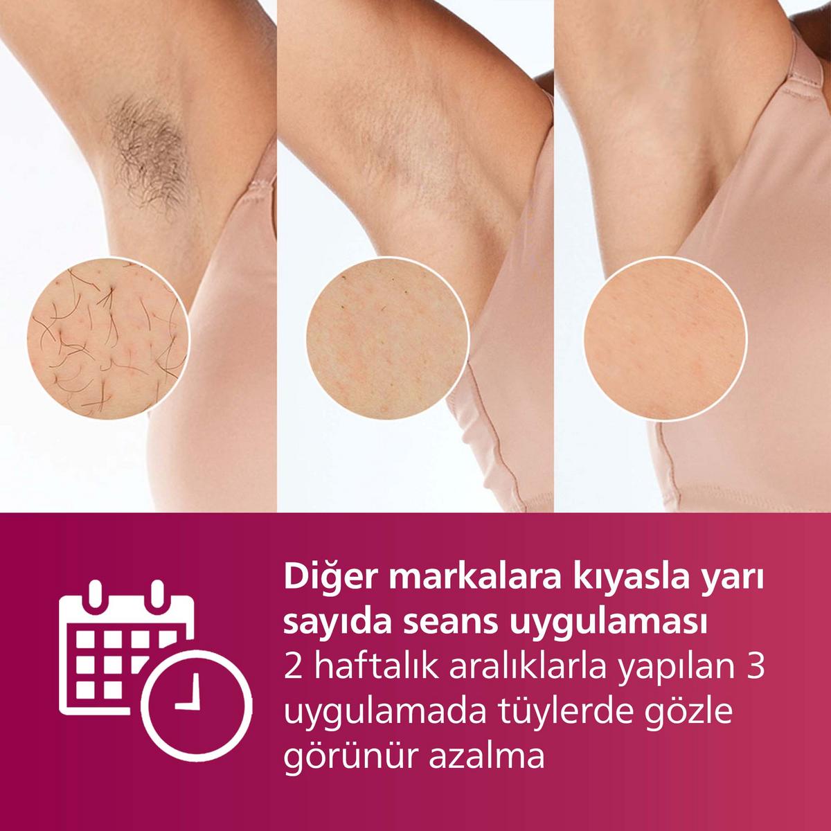 PHILIPS Lumea 7000 Serisi BRI921/00 IPL Tüy Alma, Tüy Kısaltıcı, Vücut ve Yüz için 2 Başlık, Çanta - görsel 2